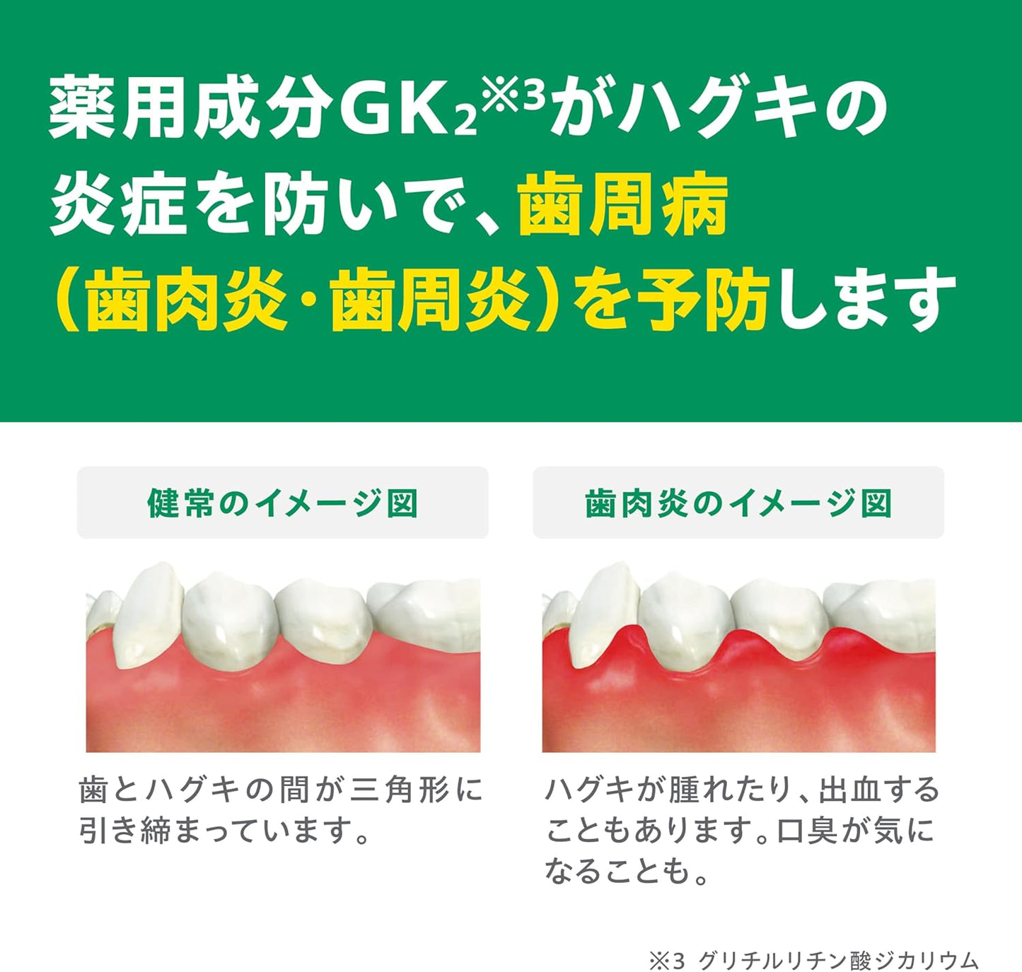 GUM(ガム) 【医薬部外品】歯周病予防 薬用ハミガキ デンタルペースト [レギュラータイプ ハーブミントタイプ] 120g×3個+おまけ付き